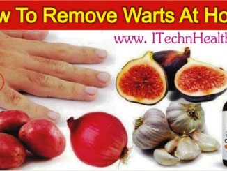 How To Remove Warts At Home