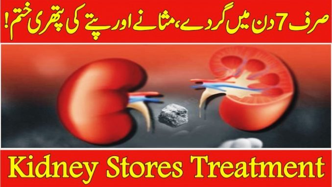 kidney stone treatment in urdu