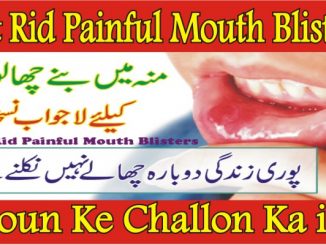 How to Get Rid Painful Mouth Blisters
