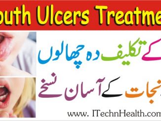 How To Cure Mouth Ulcers Fast Naturally, Mouth Ulcers Treatment