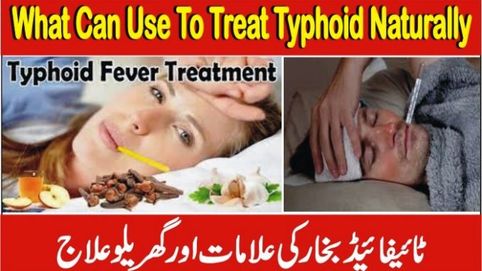 What Can I Use To Treat Typhoid Naturally, Home Remedies For Typhoid Fever
