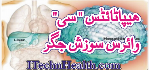 Symptoms of Hepatitis C In Urdu