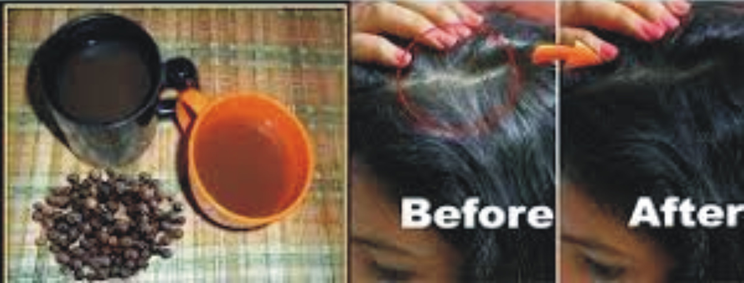 Natural Remedies To Get Rid Of White Hair 