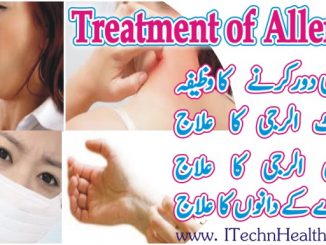 Skin Allergy Treatment In Urdu