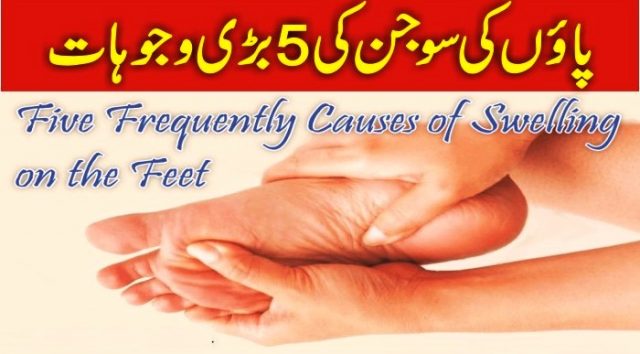 5 Reasons Of Swelling On The Feet