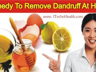 Super Remedy To Remove Dandruff Quickly At Home