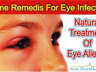 Easy Home Remedies For Eye Infection Treatment of Conjunctivitis