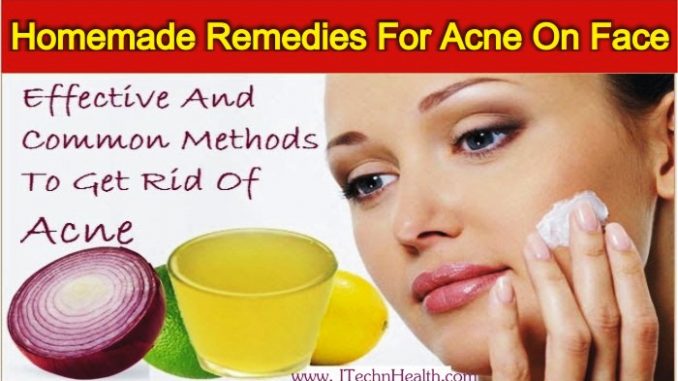 Effective Homemade Methods To Get Rid Of Acne On The Face At Home