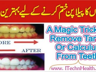 Magic Trick to Remove Tartar From Teeth