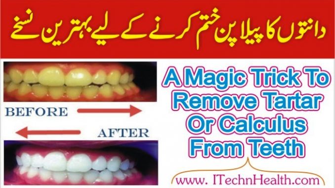 Magic Trick to Remove Tartar From Teeth