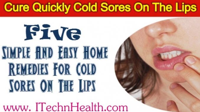 Remedies For Cold Sores On The Lips