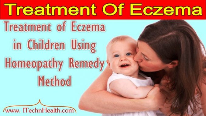 Homeopathy Treatment of Eczema - Tuberculinum Bovinum