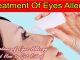 Treatment of Eyes Allergy