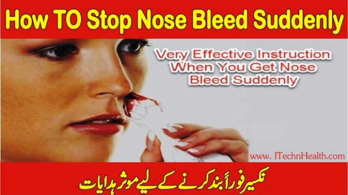 How To Stop Nose Bleed