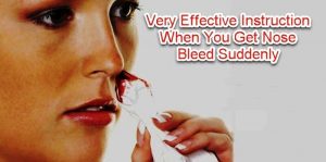 How To Stop Nose Bleed Suddenly
