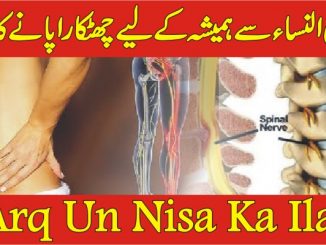 Arq un Nisa Ka Ilaj Sciatica Treatment in Urdu