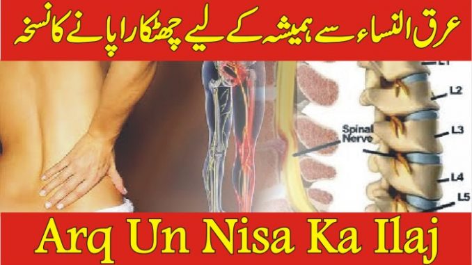 Arq un Nisa Ka Ilaj Sciatica Treatment in Urdu