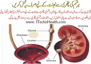 Wazifa For Kidney Pain In Urdu