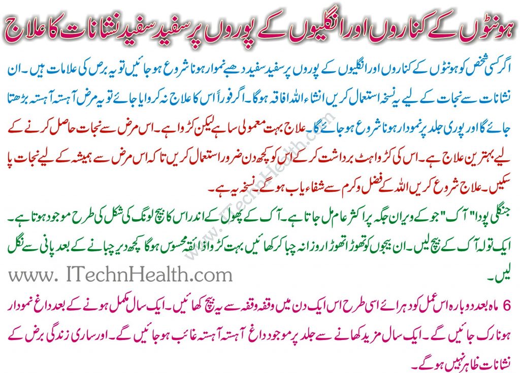 Bars Aur Phulbehri Ka Ilaj In Urdu, vitiligo Treatment, Dua for