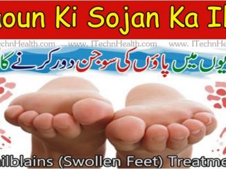 Home Remedies for Swelling Paon Ki Sujan Ka Ilaj In Urdu