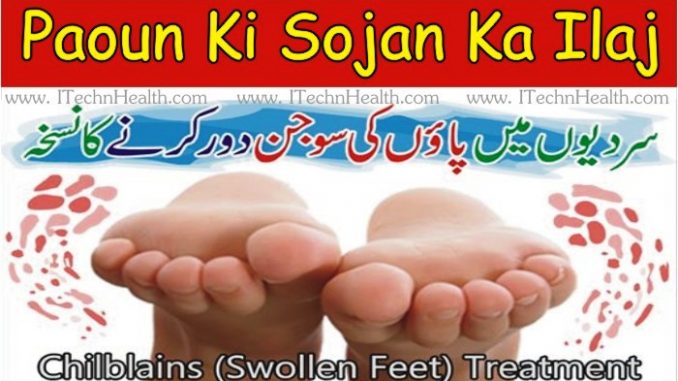 Home Remedies for Swelling Paon Ki Sujan Ka Ilaj In Urdu
