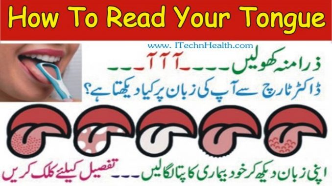 How to Read Your Tongue, White Tongue Treatment