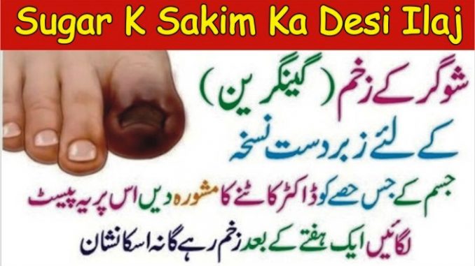 Dry Gangrene Treatment Home, Sugar K Sakim ka ilaj