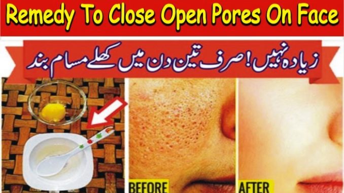 Get Face Beauty To Close Open Pores on Face Permanently