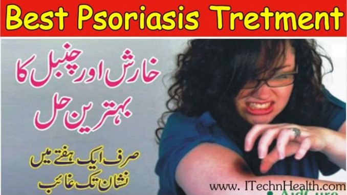 Psoriasis Treatment, Causes and Best Remedial Solution