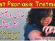 Psoriasis Treatment, Causes and Best Remedial Solution