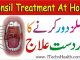 Tonsil Treatment At Home, Tonsils Ka Ilaj Ubqari