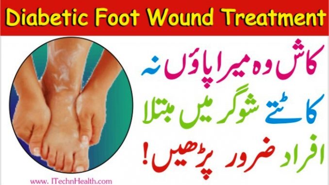 Diabetic Foot Wound Home Treatment