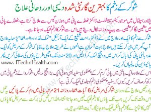 Diabetic Foot Wound Treatment In Urdu