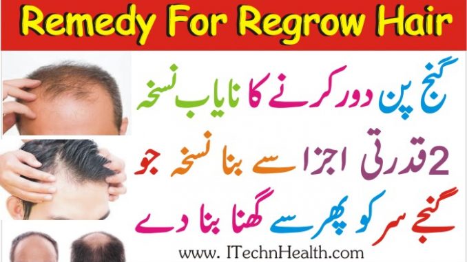 How To Stop Hair Loss Remedy For Regrow Hair Naturally