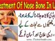 Naak ki Haddi ka ilaj, Treatment of Nose Bone in Urdu