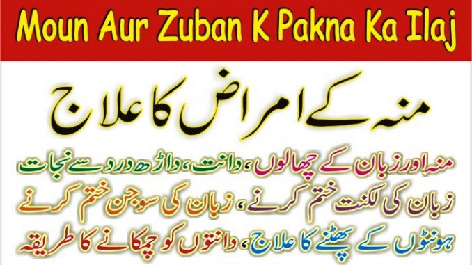 Moun Aur Zuban K Pakna Ka Ilaj