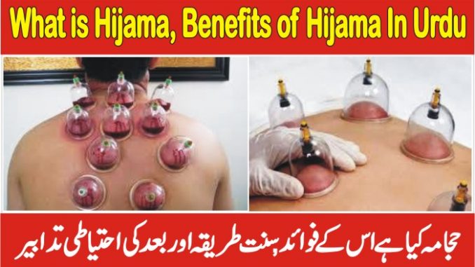 Benefits Of Hijama In Urdu