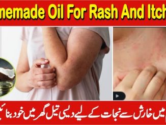 How To Stop Skin Itching, Oil For Rash And Itching In Urdu