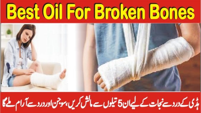 How To Heal A Broken Bone Naturally, Best Oil For Bone Fracture