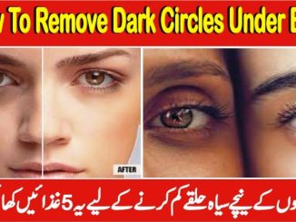 How To Remove Dark Circles Under Ey