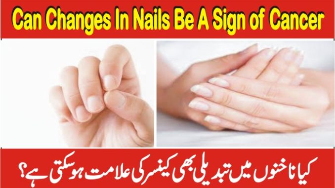 Signs Of Cancer In Fingernails, Can Changes In Nails Be A Sign Of Cancer