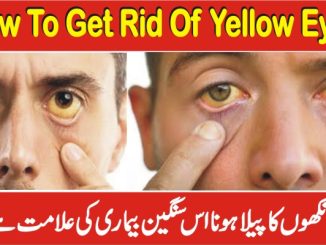 how to get rid of yellow eyes
