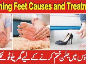 Feet Burning Treatment, Paon Ki Jalan Ka Ilaj In Urdu