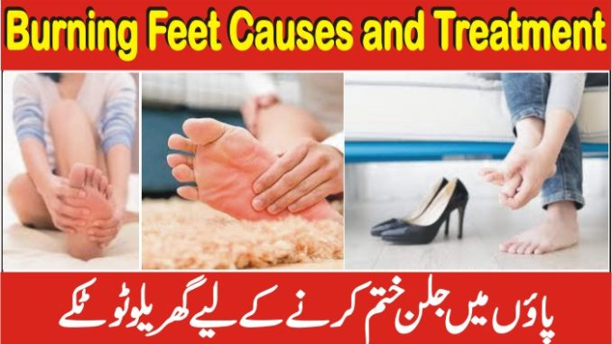 Feet Burning Treatment, Paon Ki Jalan Ka Ilaj In Urdu