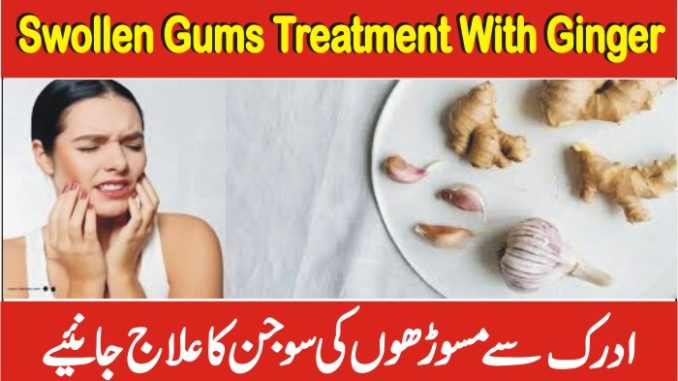 Home Remedies For Quick Relief From Gum Pain