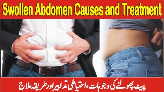 Why Is My Stomach Bloated Gas and Bloating Abdomen, Causes and Treatment