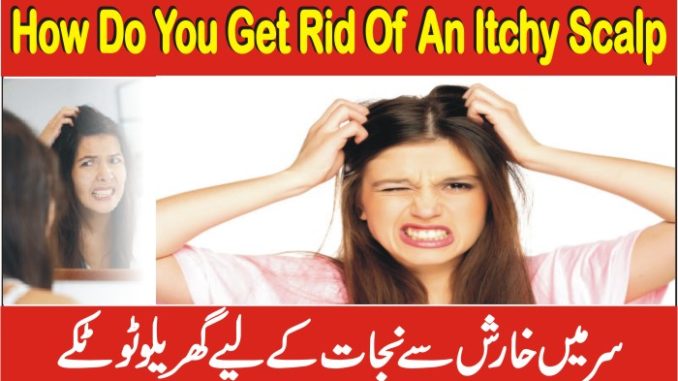 How Do You Get Rid Of An Itchy Scalp Naturally