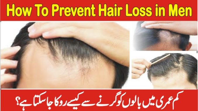 how to prevent hair loss in men