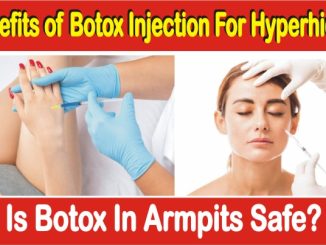 Benefits of Botox Injection For Hyperhidros