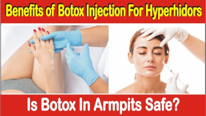 Benefits of Botox Injection For Hyperhidros